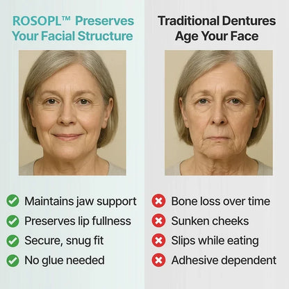 🌎Ends Today: 70% OFF! ROSOPLTM Custom-Fit Full Functional DenturesMake you more confident
